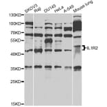 Western Blot - Anti-IL1R2 Antibody (A14072) - Antibodies.com
