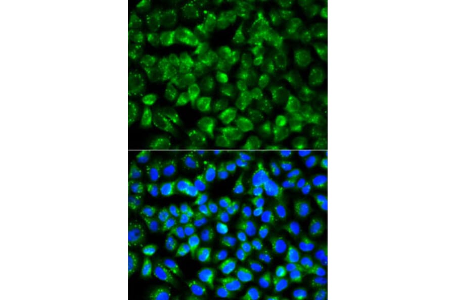 Immunofluorescence - Anti-IL1R2 Antibody (A14072) - Antibodies.com