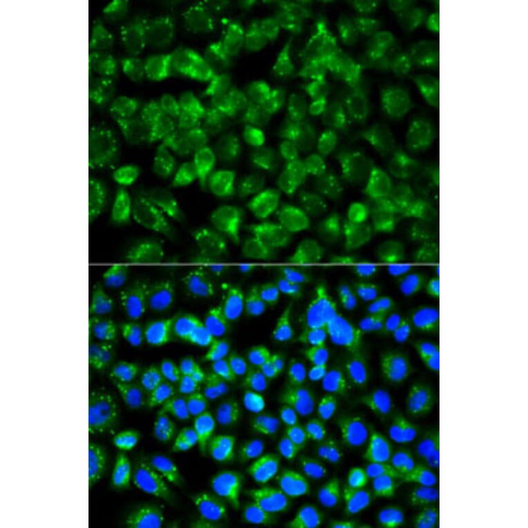 Immunofluorescence - Anti-IL1R2 Antibody (A14072) - Antibodies.com