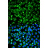 Immunofluorescence - Anti-IL1R2 Antibody (A14072) - Antibodies.com