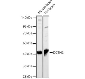 Western Blot - Anti-p50 dynamitin Antibody (A89922) - Antibodies.com