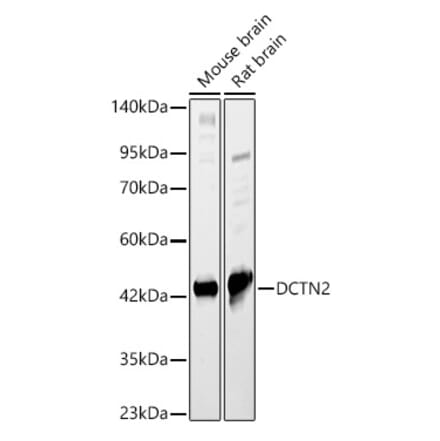 Western Blot - Anti-p50 dynamitin Antibody (A89922) - Antibodies.com