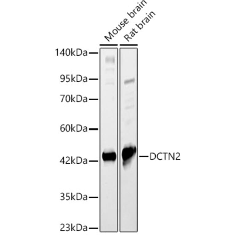 Western Blot - Anti-p50 dynamitin Antibody (A89922) - Antibodies.com