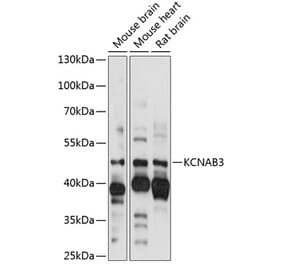 Western Blot - Anti-KCNAB3 Antibody (A89923) - Antibodies.com