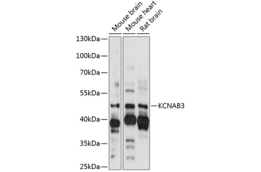 Western Blot - Anti-KCNAB3 Antibody (A89923) - Antibodies.com