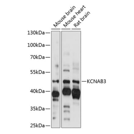 Western Blot - Anti-KCNAB3 Antibody (A89923) - Antibodies.com