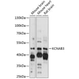 Western Blot - Anti-KCNAB3 Antibody (A89923) - Antibodies.com