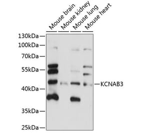 Western Blot - Anti-KCNAB3 Antibody (A89924) - Antibodies.com