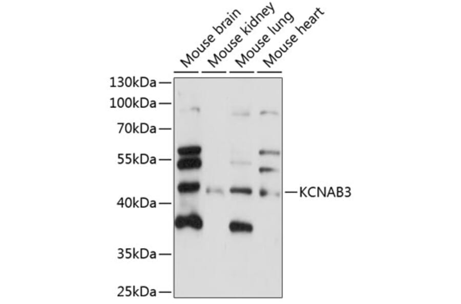 Western Blot - Anti-KCNAB3 Antibody (A89924) - Antibodies.com