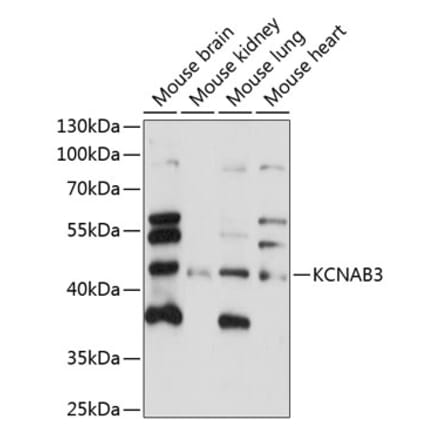 Western Blot - Anti-KCNAB3 Antibody (A89924) - Antibodies.com