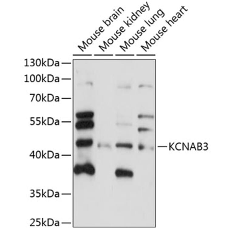 Western Blot - Anti-KCNAB3 Antibody (A89924) - Antibodies.com