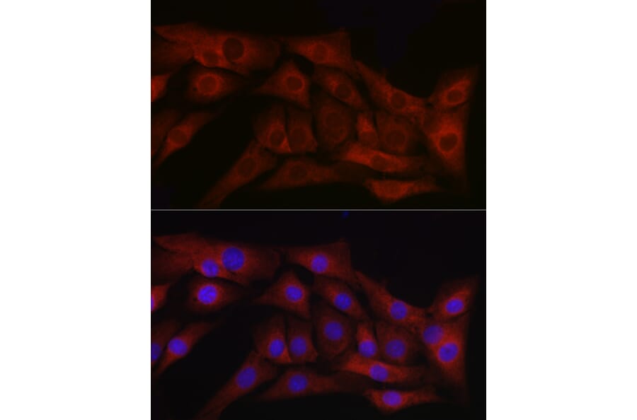 Immunofluorescence - Anti-TGF beta 1 Antibody (A89925) - Antibodies.com
