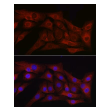 Immunofluorescence - Anti-TGF beta 1 Antibody (A89925) - Antibodies.com