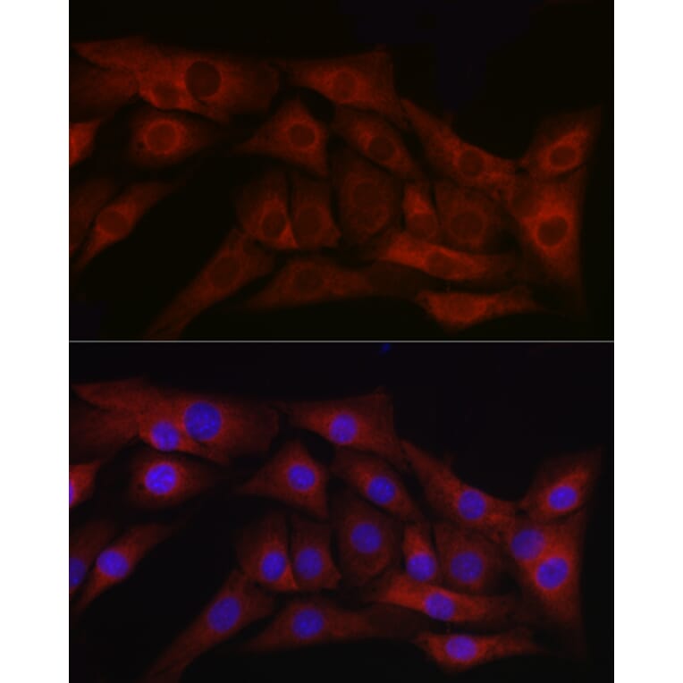 Immunofluorescence - Anti-TGF beta 1 Antibody (A89925) - Antibodies.com