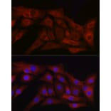 Immunofluorescence - Anti-TGF beta 1 Antibody (A89925) - Antibodies.com