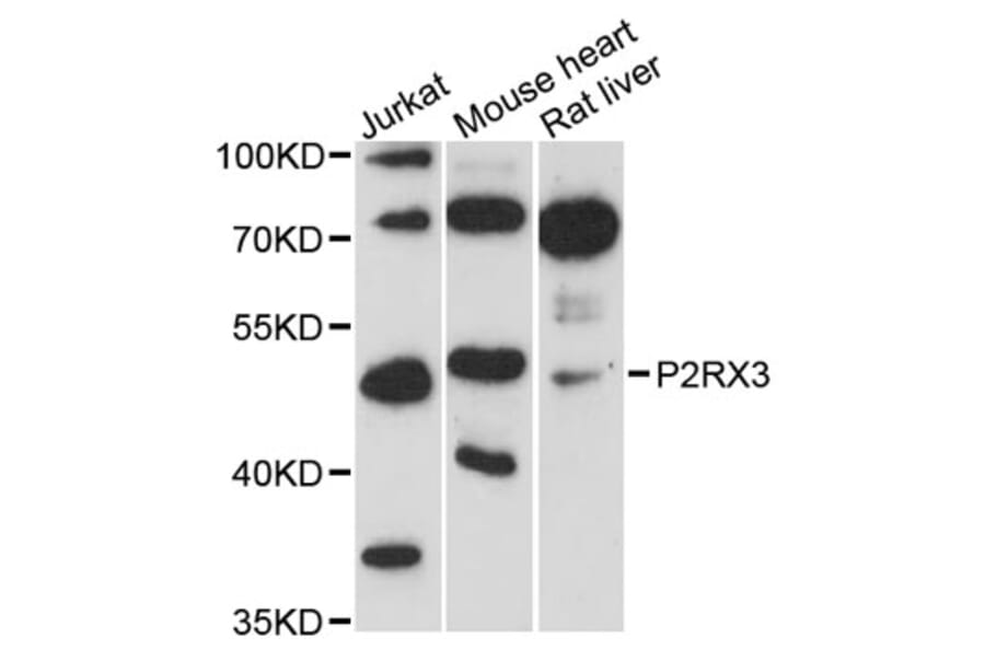 Western Blot - Anti-P2RX3 Antibody (A12924) - Antibodies.com