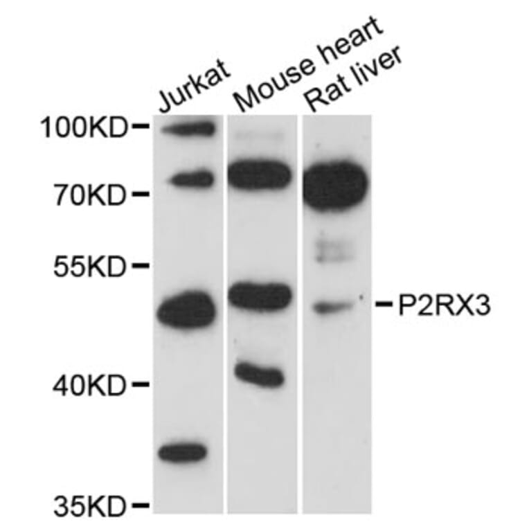 Western Blot - Anti-P2RX3 Antibody (A12924) - Antibodies.com