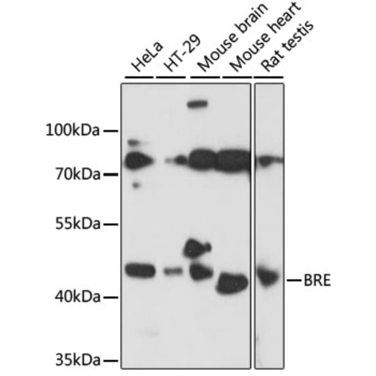 Western Blot - Anti-BRCC45/BRE Antibody (A89928) - Antibodies.com