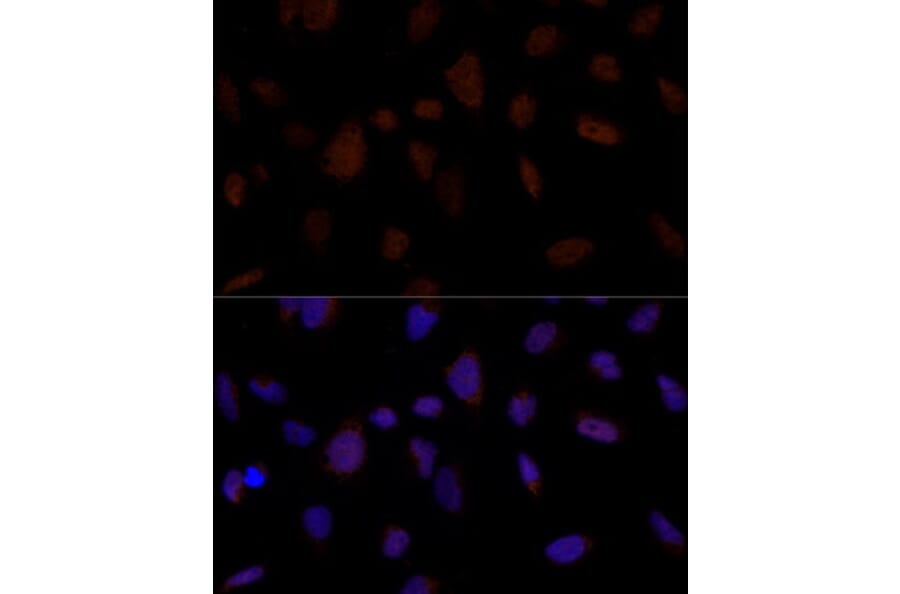 Immunofluorescence - Anti-BRCC45/BRE Antibody (A89928) - Antibodies.com