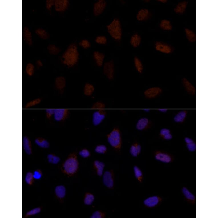 Immunofluorescence - Anti-BRCC45/BRE Antibody (A89928) - Antibodies.com