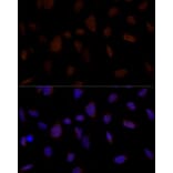Immunofluorescence - Anti-BRCC45/BRE Antibody (A89928) - Antibodies.com