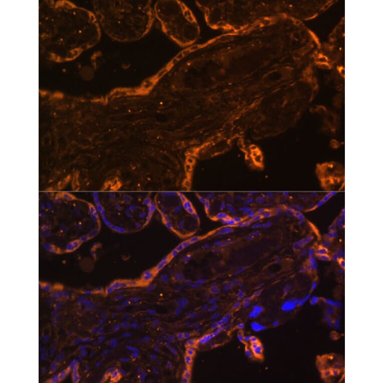 Immunofluorescence - Anti-BRCC45/BRE Antibody (A89928) - Antibodies.com