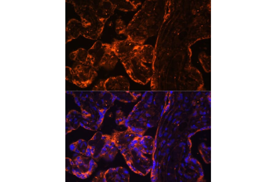 Immunofluorescence - Anti-BRCC45/BRE Antibody (A89928) - Antibodies.com