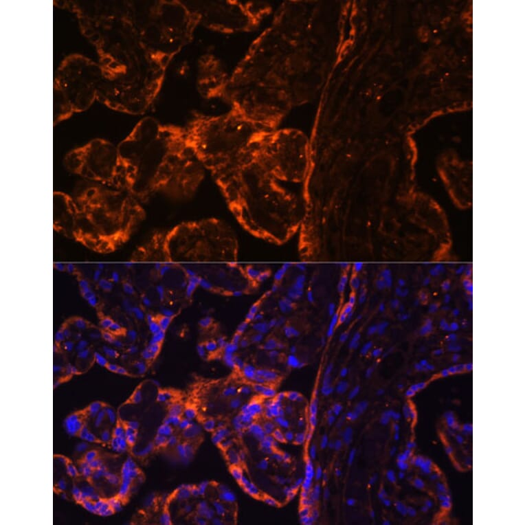 Immunofluorescence - Anti-BRCC45/BRE Antibody (A89928) - Antibodies.com