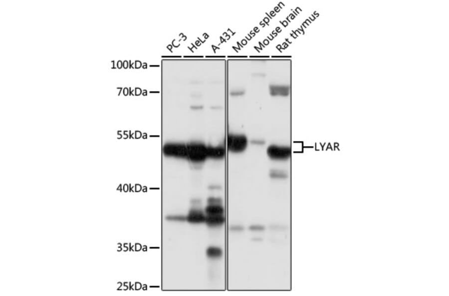 Western Blot - Anti-LYAR Antibody (A89929) - Antibodies.com