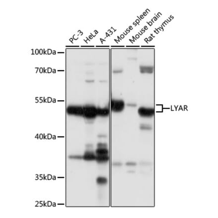 Western Blot - Anti-LYAR Antibody (A89929) - Antibodies.com