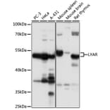 Western Blot - Anti-LYAR Antibody (A89929) - Antibodies.com
