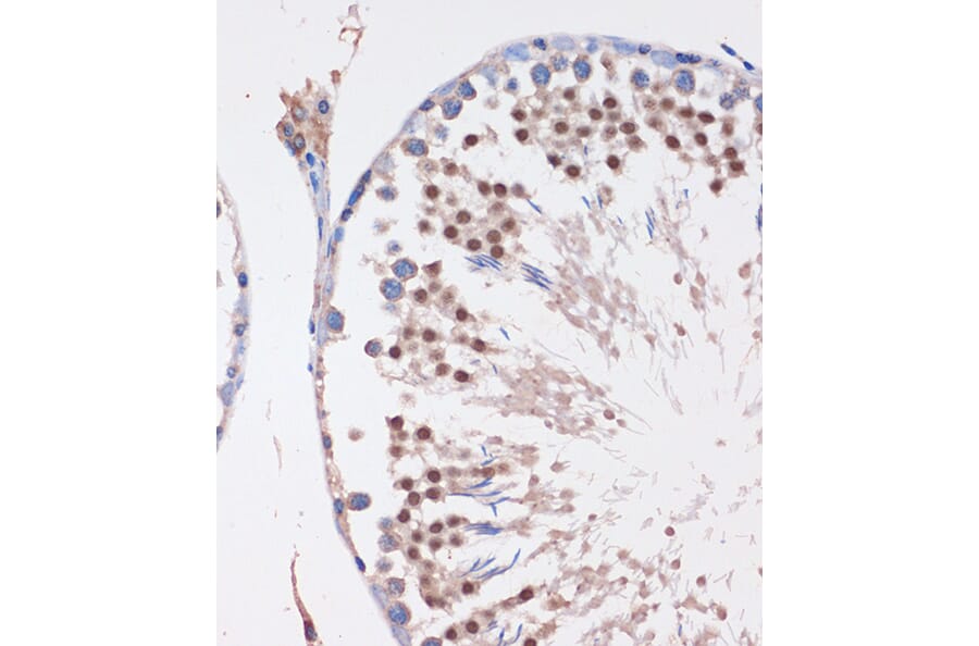 Immunohistochemistry - Anti-LYAR Antibody (A89929) - Antibodies.com