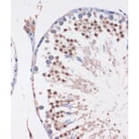 Immunohistochemistry - Anti-LYAR Antibody (A89929) - Antibodies.com