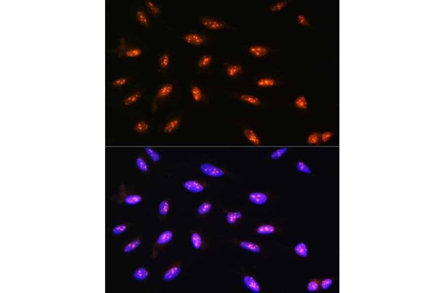 Immunofluorescence - Anti-LYAR Antibody (A89929) - Antibodies.com
