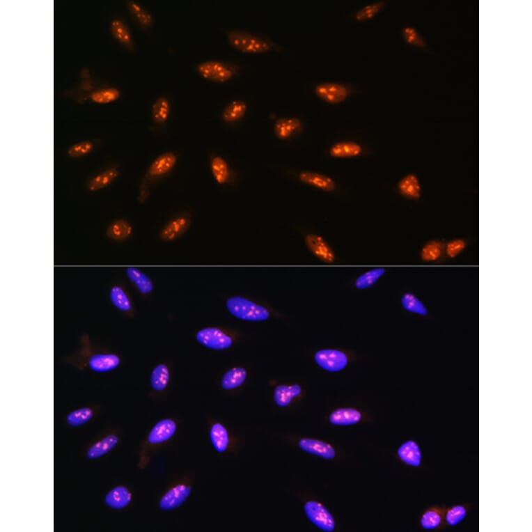 Immunofluorescence - Anti-LYAR Antibody (A89929) - Antibodies.com