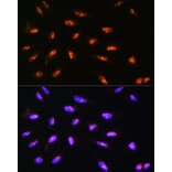 Immunofluorescence - Anti-LYAR Antibody (A89929) - Antibodies.com