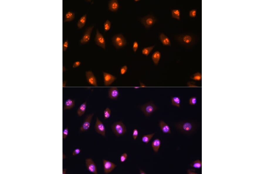 Immunofluorescence - Anti-LYAR Antibody (A89929) - Antibodies.com