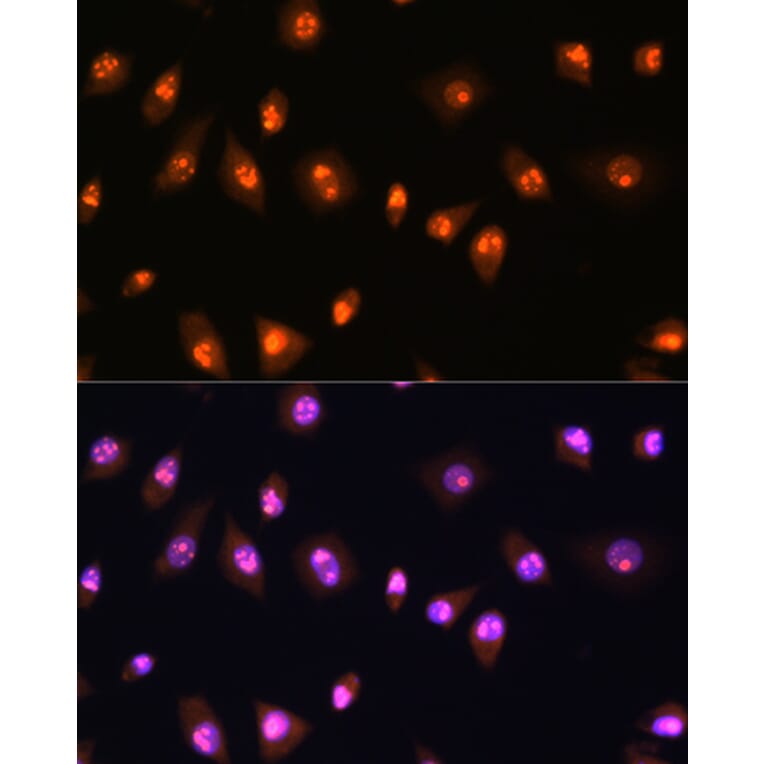 Immunofluorescence - Anti-LYAR Antibody (A89929) - Antibodies.com