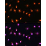 Immunofluorescence - Anti-LYAR Antibody (A89929) - Antibodies.com