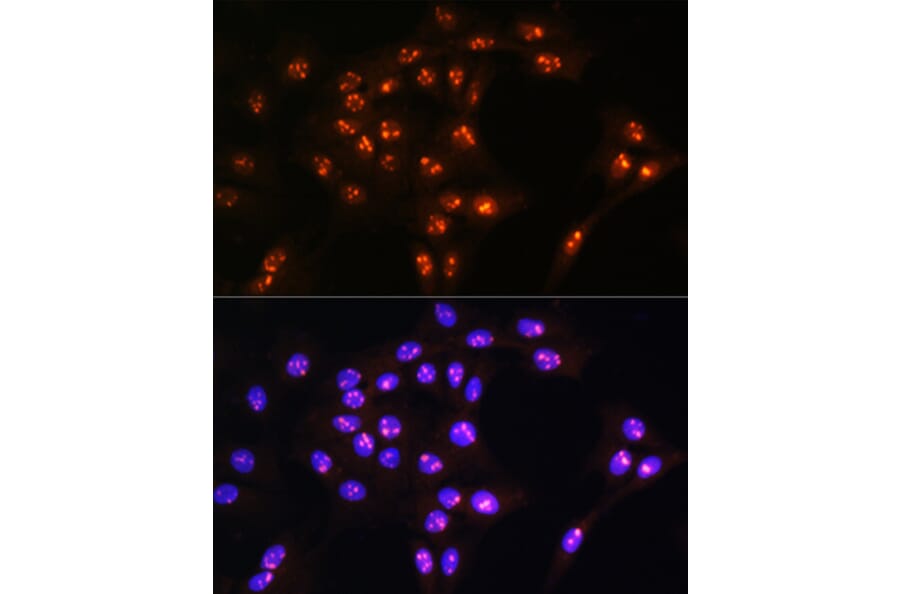Immunofluorescence - Anti-LYAR Antibody (A89929) - Antibodies.com