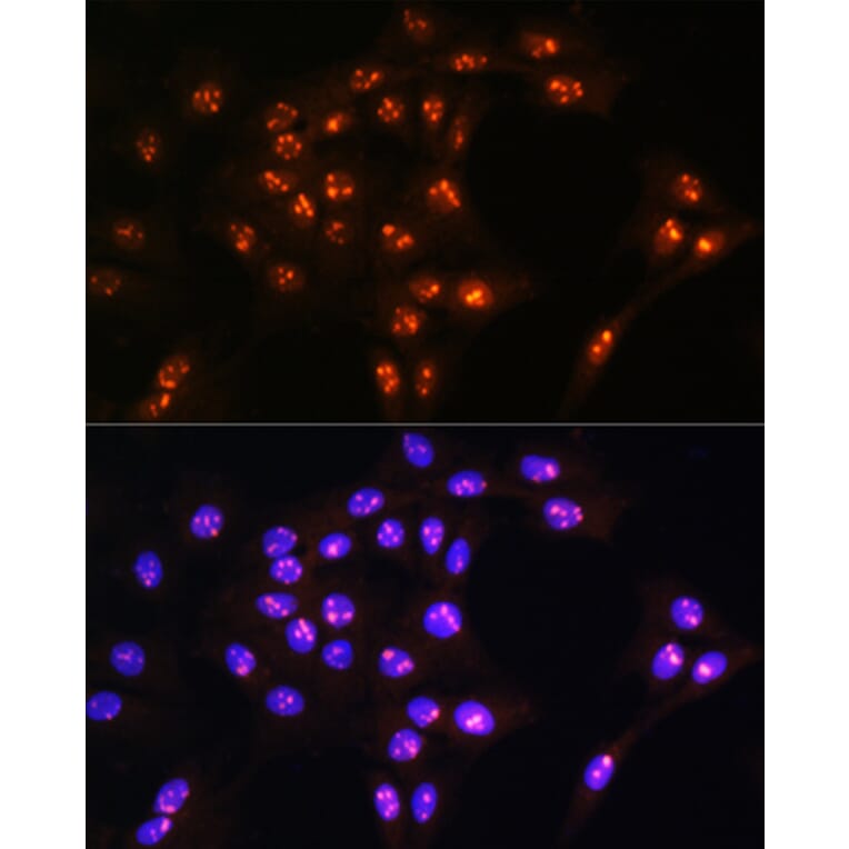 Immunofluorescence - Anti-LYAR Antibody (A89929) - Antibodies.com