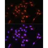 Immunofluorescence - Anti-LYAR Antibody (A89929) - Antibodies.com