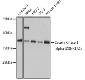 Western Blot - Anti-Casein Kinase 1 alpha Antibody (A89930) - Antibodies.com