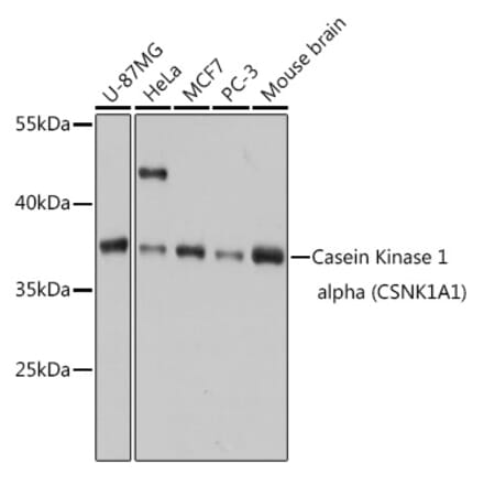 Western Blot - Anti-Casein Kinase 1 alpha Antibody (A89930) - Antibodies.com