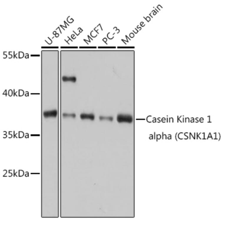 Western Blot - Anti-Casein Kinase 1 alpha Antibody (A89930) - Antibodies.com
