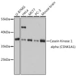Western Blot - Anti-Casein Kinase 1 alpha Antibody (A89930) - Antibodies.com