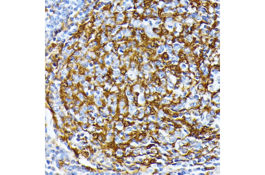 Immunohistochemistry - Anti-Casein Kinase 1 alpha Antibody (A89930) - Antibodies.com
