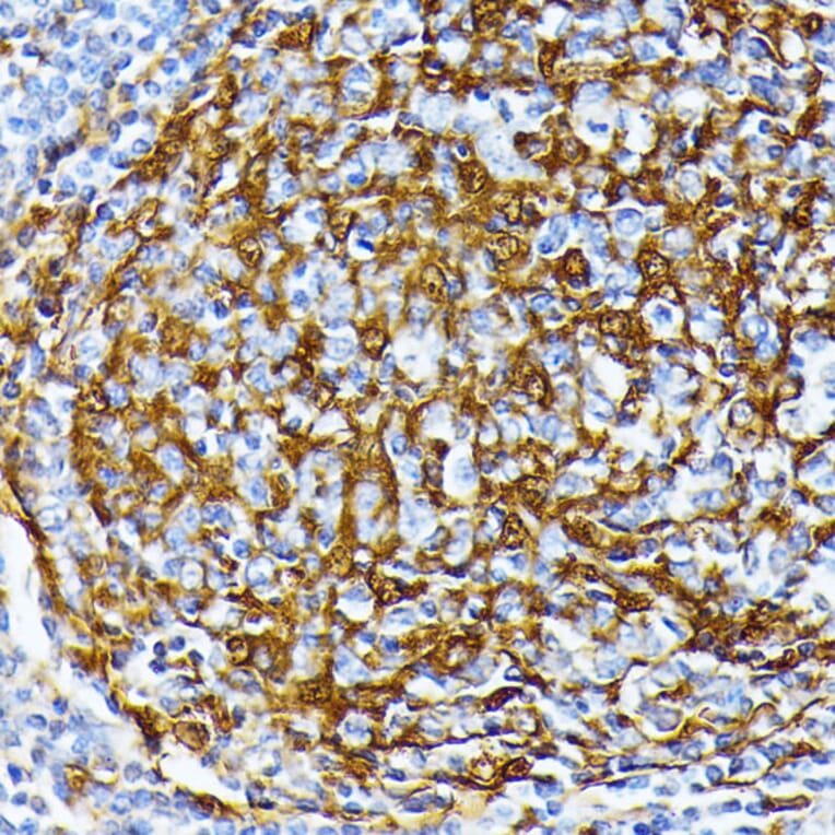 Immunohistochemistry - Anti-Casein Kinase 1 alpha Antibody (A89930) - Antibodies.com