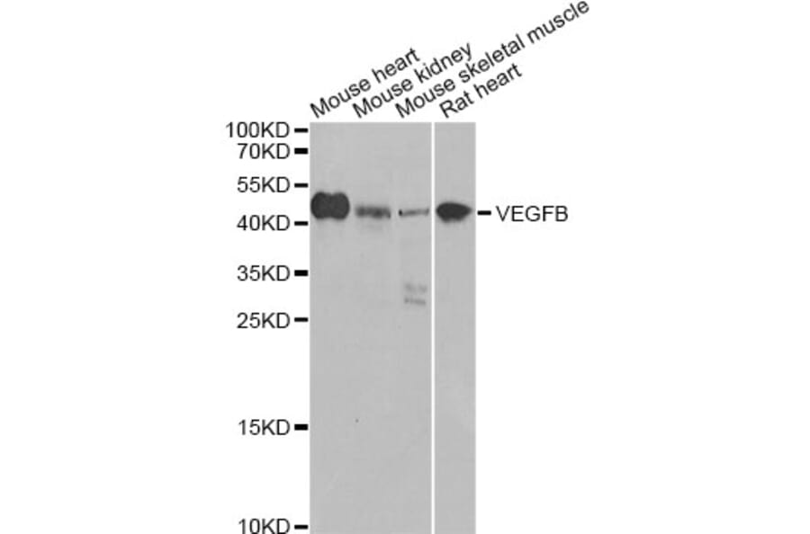 Western Blot - Anti-VEGFB Antibody (A0544) - Antibodies.com