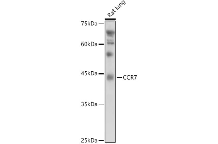 Western Blot - Anti-CCR7 Antibody (A89932) - Antibodies.com